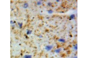 Used in DAB staining on fromalin fixed paraffin-embedded Brain tissue (GSTA4 抗体  (AA 3-222))
