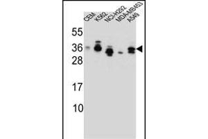 SSX4 Antibody (Center) (ABIN657137 and ABIN2837900) western blot analysis in CEM,K562,NCI-,MDA-M,A549 cell line lysates (35 μg/lane). (SSX4 抗体  (AA 63-91))