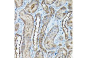 Immunohistochemistry (IHC) image for anti-Chromosome 9 Open Reading Frame 72 (C9ORF72) (AA 1-230) antibody (ABIN7266391)