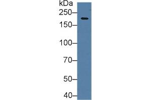 Western blot analysis of Mouse Cerebrum lysate, using Human HIF2a Antibody (2 µg/ml) and HRP-conjugated Goat Anti-Rabbit antibody (