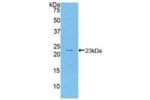 Western blot analysis of recombinant Human HSPb2. (HSPB2 抗体  (AA 12-182))