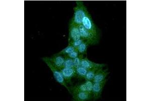 ICC/IF analysis of GSTT1 in HepG2 cells line, stained with DAPI (Blue) for nucleus staining and monoclonal anti-human GSTT1 antibody (1:100) with goat anti-mouse IgG-Alexa fluor 488 conjugate (Green). (GSTT1 抗体)
