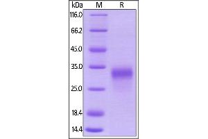 SDS-PAGE (SDS) image for Placenta Growth Factor (PGF) (AA 19-170) (Active) protein (His tag) (ABIN5955014)