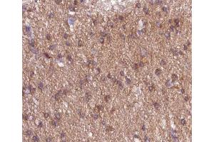 ABIN6267616 at 1/200 staining human brain tissue sections by IHC-P.