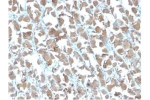 Formalin-fixed, paraffin-embedded human stomach stained with MICA Mouse Recombinant Monoclonal Antibody (MICA/4442).