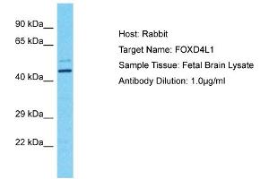 Host: Rabbit Target Name: FOXD4L1 Sample Tissue: Human Fetal Brain Antibody Dilution: 1ug/ml