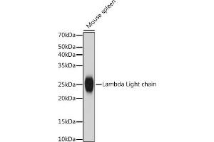 Western blot analysis of extracts of Mouse spleen, using Lambda Light chain antibody (ABIN7267847) at 1:1000 dilution. (IGLV1-51 抗体)