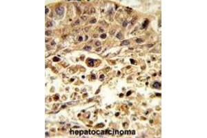 Immunohistochemistry (IHC) image for anti-Vacuolar Protein Sorting-Associated Protein 26A (VPS26A) antibody (ABIN3003886) (VPS26A 抗体)