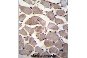 PIK3C2A Antibody immunohistochemistry analysis in formalin fixed and paraffin embedded human skeletal muscle followed by peroxidase conjugation of the secondary antibody and DAB staining. (PIK3C2A 抗体  (C-Term))