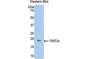Western blot analysis of the recombinant protein. (WISP1 抗体  (AA 213-350))