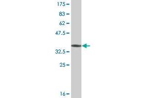 Western Blot detection against Immunogen (36. (COQ8A 抗体  (AA 1-100))
