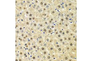 Immunohistochemistry of paraffin-embedded rat liver using SPHK1 Antibody (ABIN5970017) at dilution of 1/100 (40x lens). (SPHK1 抗体)