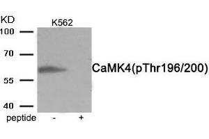 Western blot analysis of extracts from K562 cells treated with H2O2 using Phospho-CaMK4 (Thr196/200) antibody.