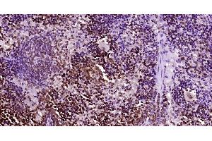 Paraformaldehyde-fixed, paraffin embedded Mouse spleen, Antigen retrieval by boiling in sodium citrate buffer (pH6. (NK-1.1/CD161c 抗体  (AA 101-200))