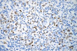 anti-Aurora Kinase B (AURKB) antibody