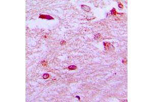 Immunohistochemical analysis of ETV1 staining in human brain formalin fixed paraffin embedded tissue section. (ETV1 抗体  (N-Term))