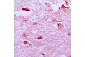 Immunohistochemical analysis of ETV1 staining in human brain formalin fixed paraffin embedded tissue section.