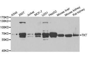 Western blot analysis of extracts of various cell lines, using TKT antibody. (TKT 抗体  (AA 1-280))