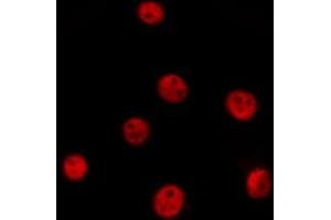 ABIN6277089 staining  Hela cells by IF/ICC. (PIN1 抗体  (N-Term))