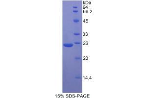 SDS-PAGE analysis of Rat MYH8 Protein. (MYH8 蛋白)