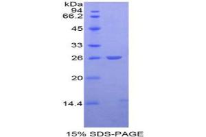 SDS-PAGE analysis of Mouse APC Protein. (APC 蛋白)