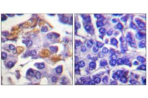Immunohistochemistry (IHC) image for anti-V-Raf-1 Murine Leukemia Viral Oncogene Homolog 1 (RAF1) (pTyr341) antibody (ABIN1847298) (RAF1 抗体  (pTyr341))