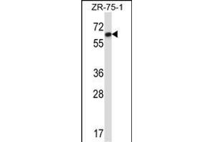 DCTN4 Antibody (N-term) (ABIN657377 and ABIN2846423) western blot analysis in ZR-75-1 cell line lysates (35 μg/lane). (Dynactin 4 抗体  (N-Term))