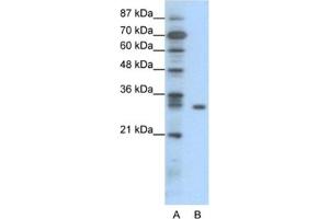 Western Blotting (WB) image for anti-NF-kappa-B inhibitor beta (NFKBIB) antibody (ABIN2460933) (NFKBIB 抗体)