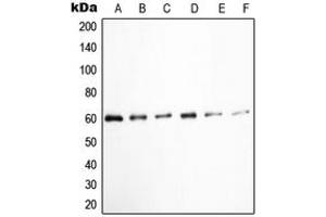 Western blot analysis of c-SRC (pY529) expression in K562 (A), HuvEc (B), Jurkat (C), COLO205 (D), HEK293T EGF-treated (E), A431 pervanadate-treated (F) whole cell lysates. (Src 抗体  (C-Term, pTyr529))