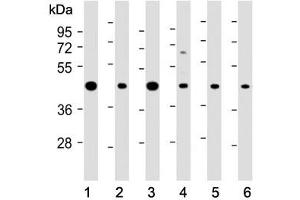 Western blot testing of human 1) A431, 2) MOLT4, 3) Jurkat, 4) PC-12, 5) mouse NIH3T3 and 6) mouse brain lysate with ASS1 antibody at 1:2000.