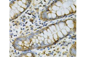 Immunohistochemistry of paraffin-embedded Human colon using GSTM2 Polyclonal Antibody at dilution of 1:100 (40x lens). (GSTM2 抗体)