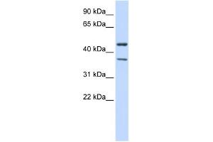 WB Suggested Anti-KCNJ4 Antibody Titration:  0. (KCNJ4 抗体  (Middle Region))