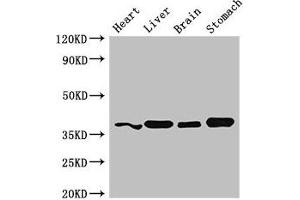 Western Blot Positive WB detected in: Mouse heart tissue, Mouse liver tissue, Mouse brain tissue, Mouse stomach tissue All lanes: YIPF3 antibody at 3 μg/mL Secondary Goat polyclonal to rabbit IgG at 1/50000 dilution Predicted band size: 39 kDa Observed band size: 39 kDa (YIPF3 抗体  (AA 2-148))