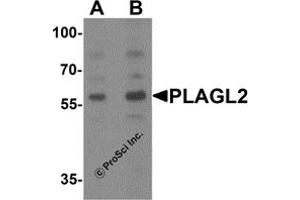 Western Blotting (WB) image for anti-Pleiomorphic Adenoma Gene-Like 2 (PLAGL2) (N-Term) antibody (ABIN1077381) (PLAGL2 抗体  (N-Term))