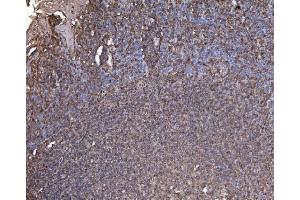 IHC analysis of RAB1B using anti-RAB1B antibody (ABIN7602809). (RAB1B 抗体  (C-Term))