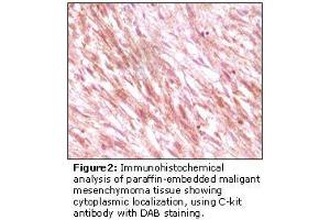 Image no. 2 for anti-Mast/stem Cell Growth Factor Receptor (KIT) antibody (ABIN232128) (KIT 抗体)