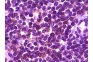 Immunohistochemistry (IHC) image for anti-B Lymphoid Tyrosine Kinase (BLK) (truncated) antibody (ABIN2464018) (BLK 抗体  (truncated))