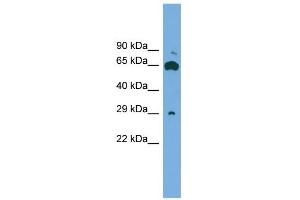 WB Suggested Anti-GLIPR1L1 Antibody Titration: 0. (GLIPR1L1 抗体  (Middle Region))