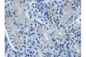 Immunohistochemistry (IHC) image for anti-Transforming Growth Factor, beta-Induced, 68kDa (TGFBI) (AA 423-632) antibody (ABIN7431149)