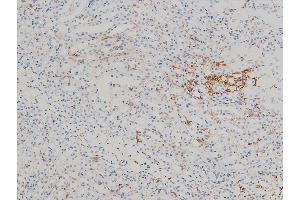 Immunohistochemistry (IHC) image for anti-Cofilin 1 (CFL1) (pSer3) antibody (ABIN6255180)