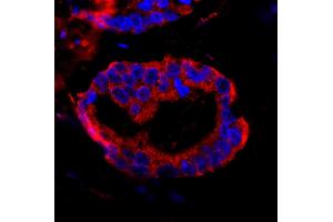 Immunofluorescence (IF) image for anti-Coiled-Coil and C2 Domain Containing 1A (CC2D1A) (AA 1-50) antibody (ABIN7448937)