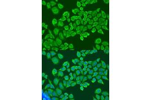 Immunofluorescence analysis of U2OS cells using IGF2BP2 antibody.
