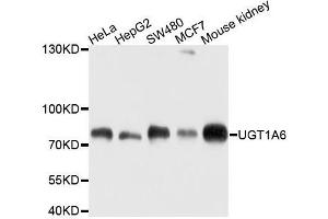 Western blot analysis of extracts of various cell lines, using UGT1A6 antibody. (UGT1A6 抗体  (AA 65-270))