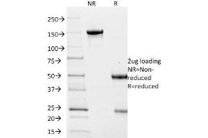 SDS-PAGE Analysis Purified Villin Mouse Monoclonal Antibody (VIL1/2376). (Villin 1 抗体  (AA 179-311))