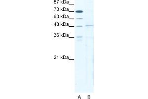 WB Suggested Anti-TBX5 Antibody   Titration: 5 ug/ml   Positive Control: HepG2 Whole Cell (T-Box 5 抗体  (N-Term))