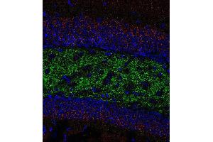 Immunohistochemistry (Paraffin-embedded Sections) (IHC (p)) image for anti-Solute Carrier Family 30 (Zinc Transporter), Member 3 (Slc30a3) (AA 2-75) antibody (ABIN1742413)
