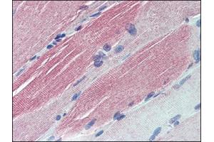 Immunohistochemistry: Human Skeletal Muscle: Formalin-Fixed, Paraffin-Embedded (FFPE). (IGFBP6 抗体  (Internal Region))