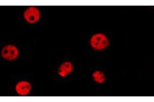 ABIN6278641 staining HepG2 by IF/ICC. (T-Box 15/18 抗体)