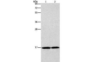 Western Blot analysis of Mouse heart and Human fetal brain tissue using GMFG Polyclonal Antibody at dilution of 1:1142 (GMFG 抗体)