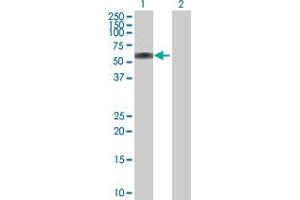 Western Blot analysis of ATP6AP1 expression in transfected 293T cell line by ATP6AP1 MaxPab polyclonal antibody. (ATP6AP1 抗体  (AA 1-470))